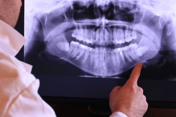 Best Emergency Dental Care for Abscessed Tooth in Libertyvle, IL